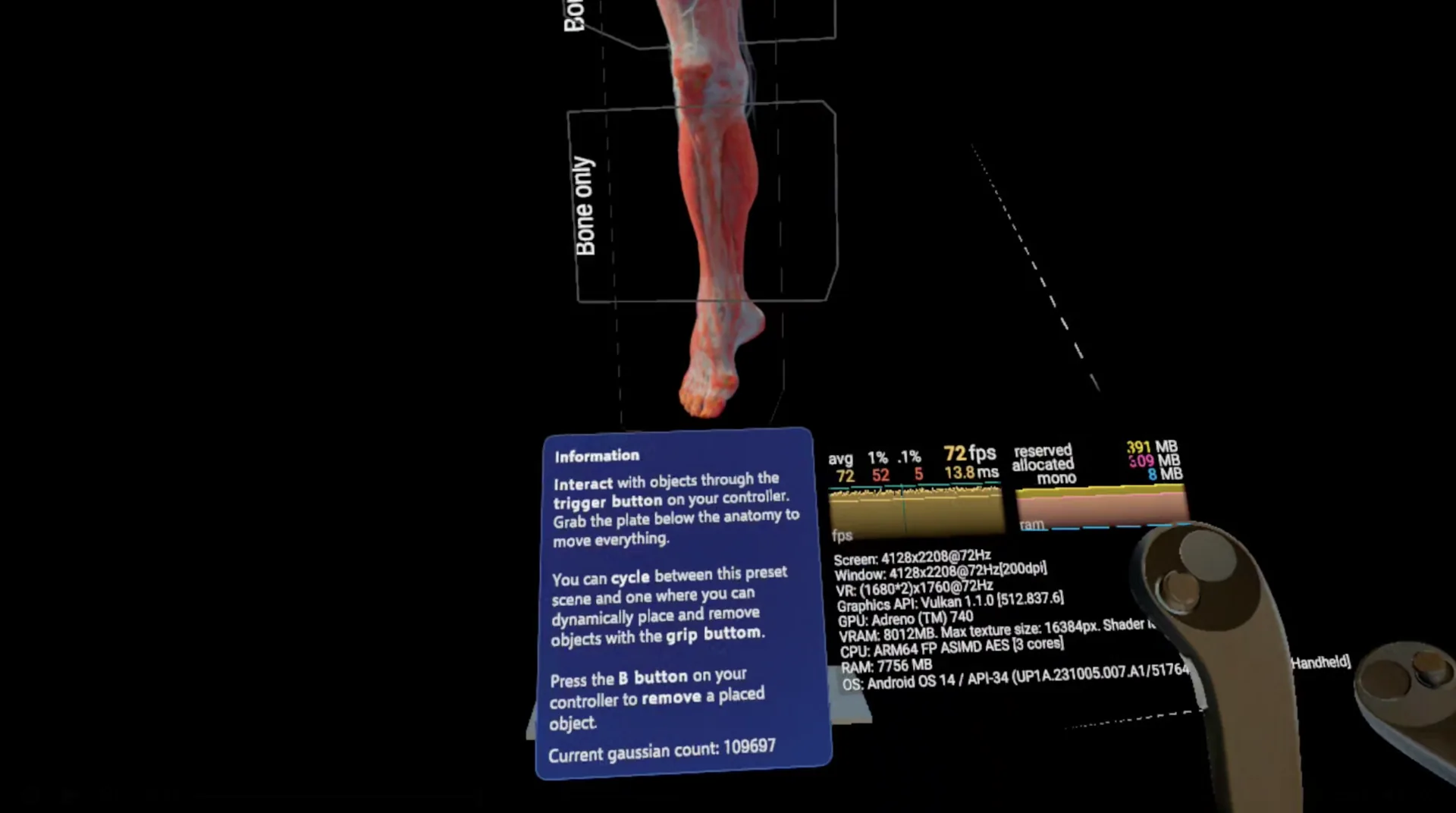 AnatomyLens VR layered anatomy inspection
